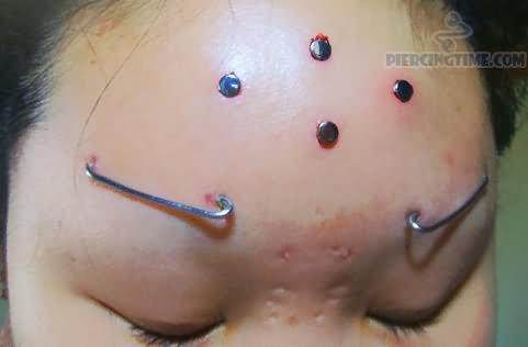 Dermals And Flesh Stapling Piercing On Forehead