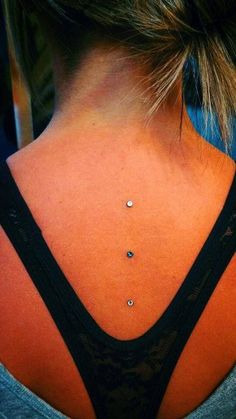 Girl With Upper Back With Dermals