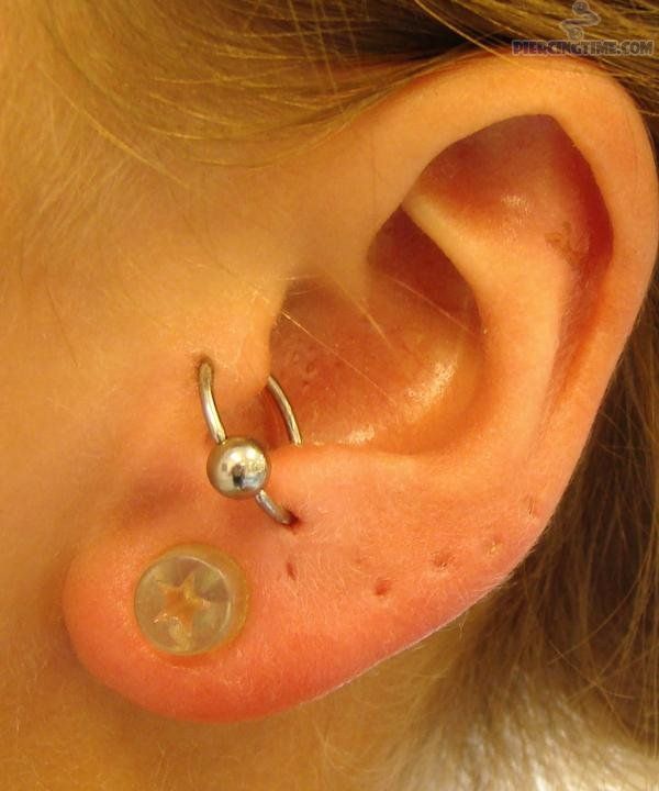 Tragus to anti-tragus Orbital Set Piercing On Left Ear