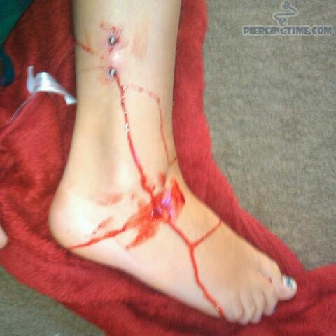 Recently Done Ankle Piercing