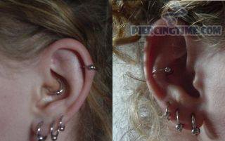 daithtriple-lobe-and-helix-piercing