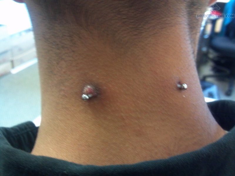 surface-piercing-on-neck-with-small-dermals